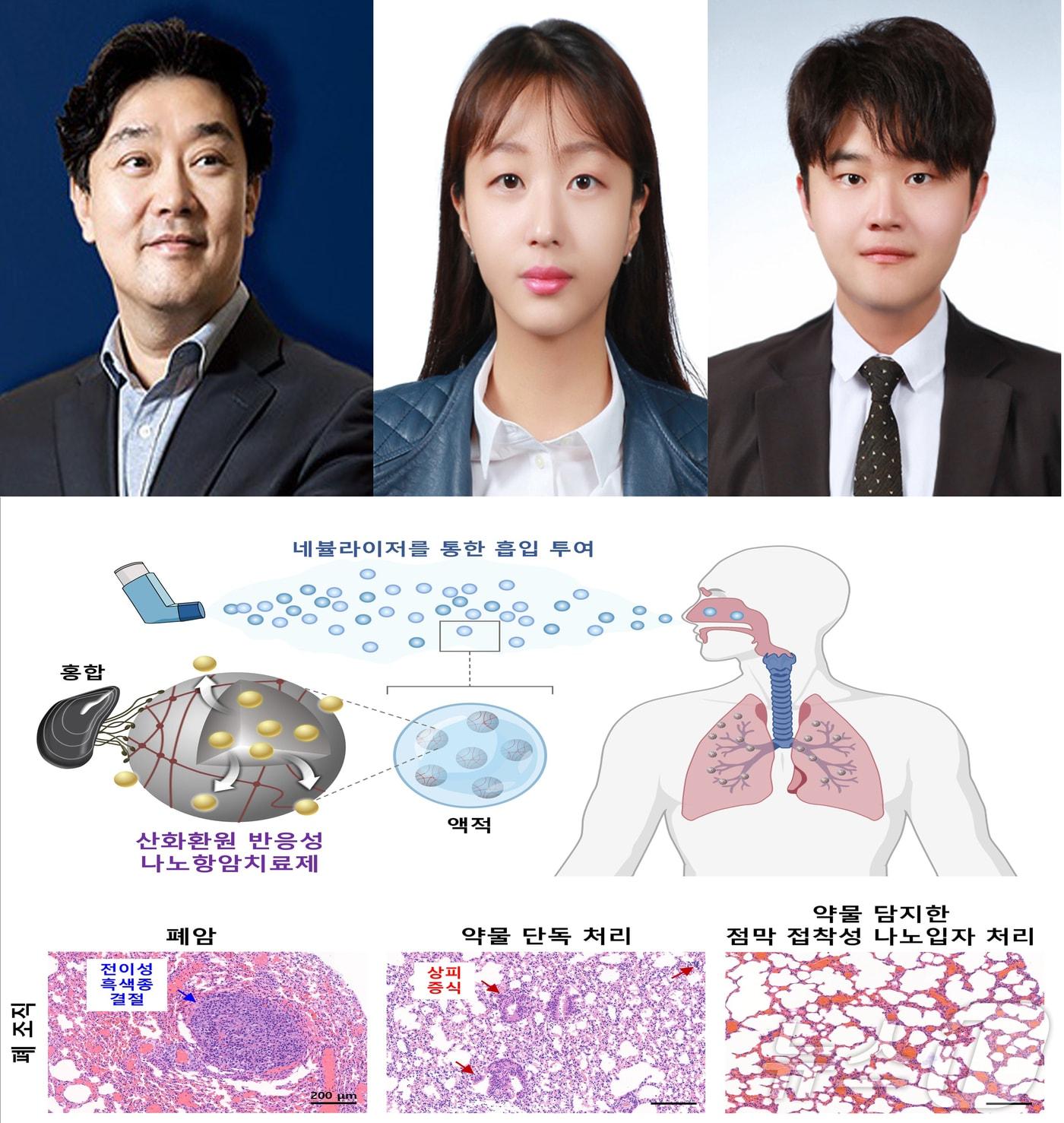 본문 이미지 - 포스텍&#40;포항공대&#41;과 경북대 공동연구팀이 홍합 접착 단백질을 활용한 폐암 치료용 흡입형 생체 나노입자를 개발했다고 2일 밝혔다. 사진 왼쪽부터 차형준 교수, 정연수 박사,  조윤기 교수, 연구성과 이미지. &#40;포스텍제공&#41; 20251.2/뉴스1