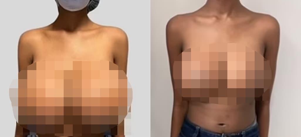 본문 이미지 - &#40;PRS글로벌오픈 갈무리&#41;