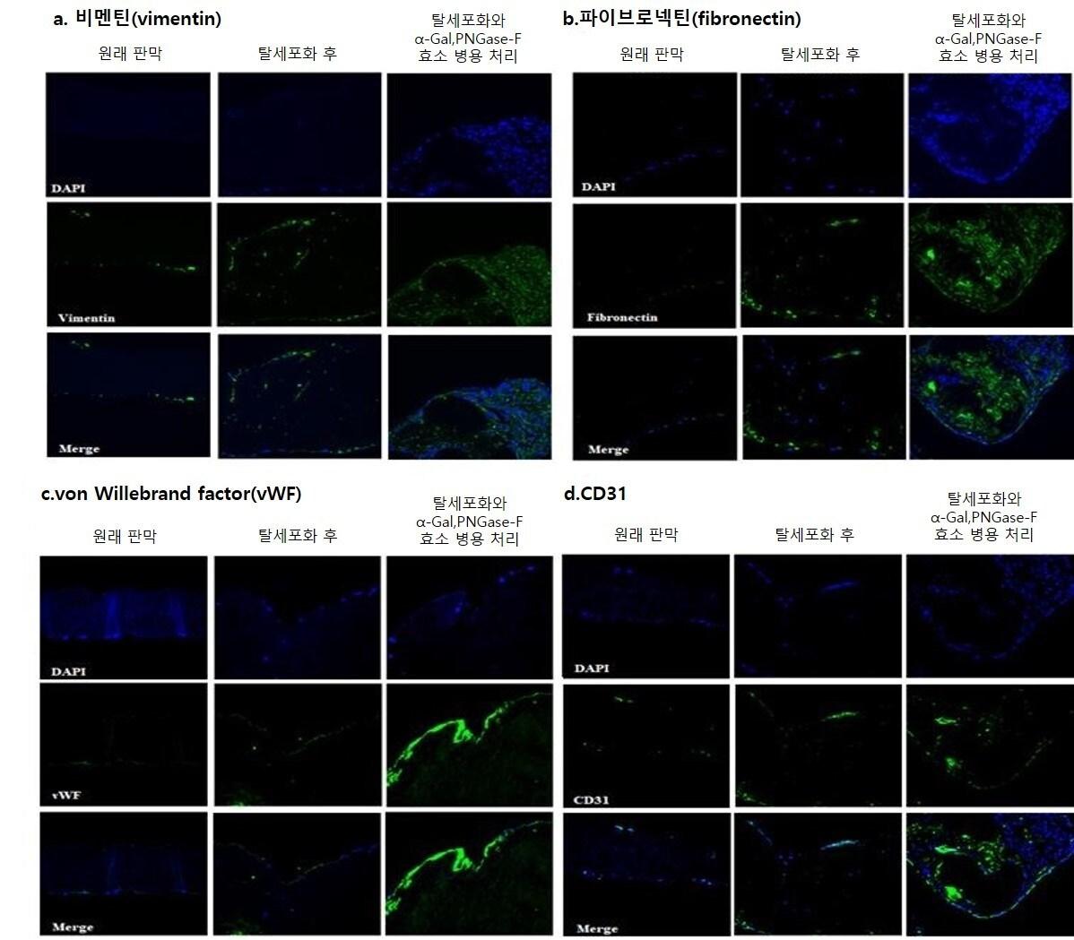 본문 이미지 - α-갈락토시다아제&#40;α-Gal&#41;와 PNGase-F로 처리한 이종조직판막에 사람 줄기세포와 제대정맥 내피세포를 공배양했을 때 재세포화가 촉진된 모습&#40;초록색 발현량 증가&#41; &#40;서울대병원 제공&#41;