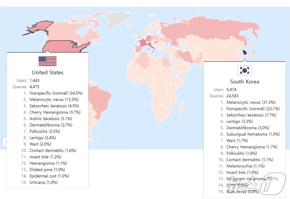 본문 이미지 - 국내 연구진이 세계 각국의 피부질환 발병 현황과 국민 관심도를 실시간으로 보여주는 '피부질환 세계지도'를 개발했다. 세계보건기구(WHO)도 국가별 피부질환 통계를 명확히 집계하지 못하는 가운데, 실시간 데이터로 전 세계 피부질환 패턴을 분석 및 시각화한 것은 이번이 처음이다.(분당서울대병원 제공)