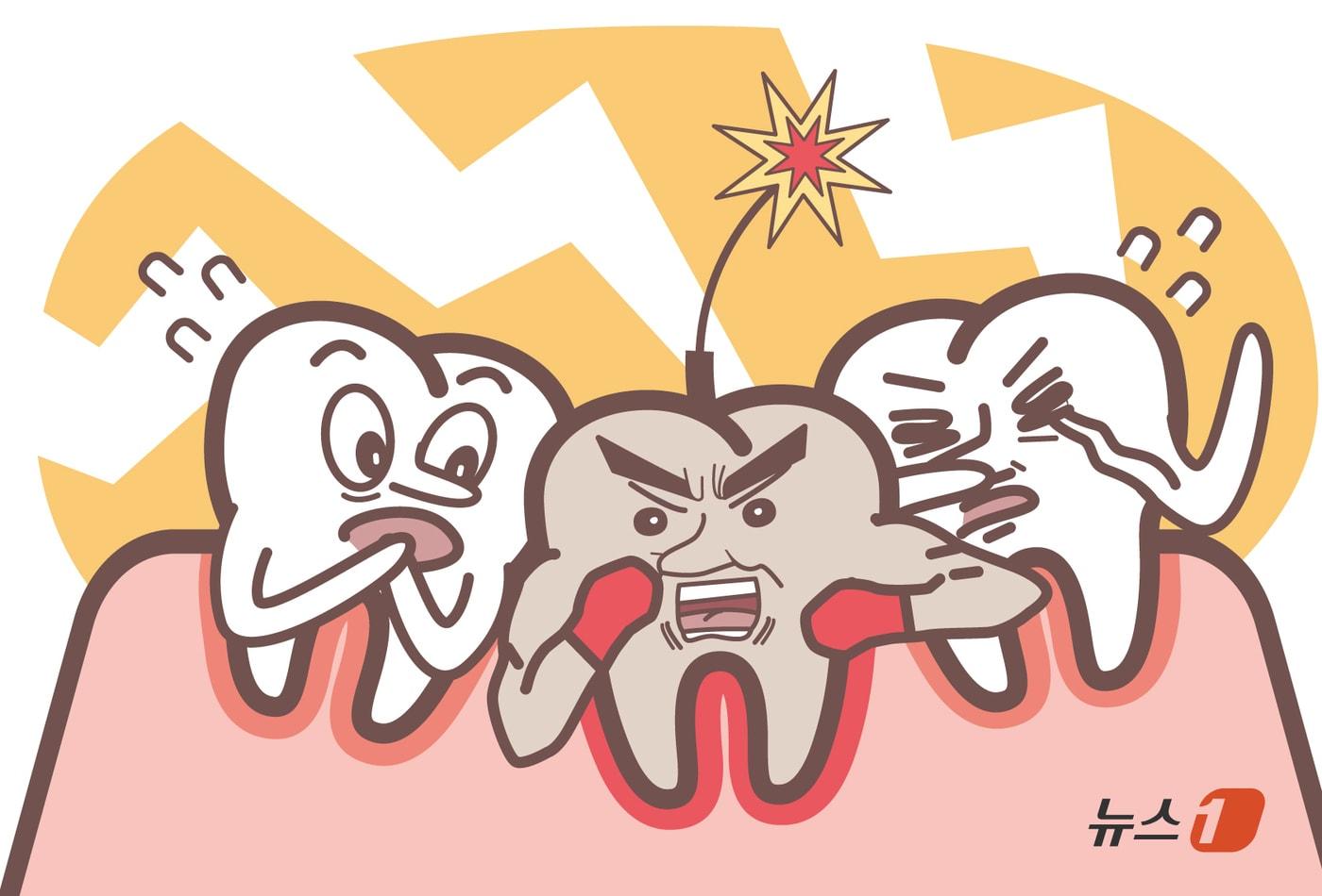 사람은 평생 20개의 유치를 거쳐 32개의 영구치까지 총 52개의 치아를 가지고 살게 되지만, 이보다 많거나 불필요한 치아가 추가로 생기는 경우를 &#39;과잉치&#39;라 한다. ⓒ News1 김초희 디자이너