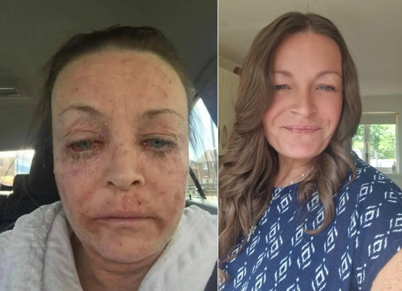 본문 이미지 - (더 선 갈무리)