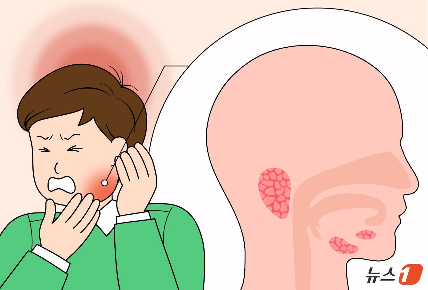 침샘에 문제가 생기면 부차적 문제를 일으킨다. 침샘은 턱 주변에 주로 위치함으로 문제가 생기면 마치 턱이 아픈 것처럼 느낄 수 있다.  ⓒ News1 윤주희 디자이너