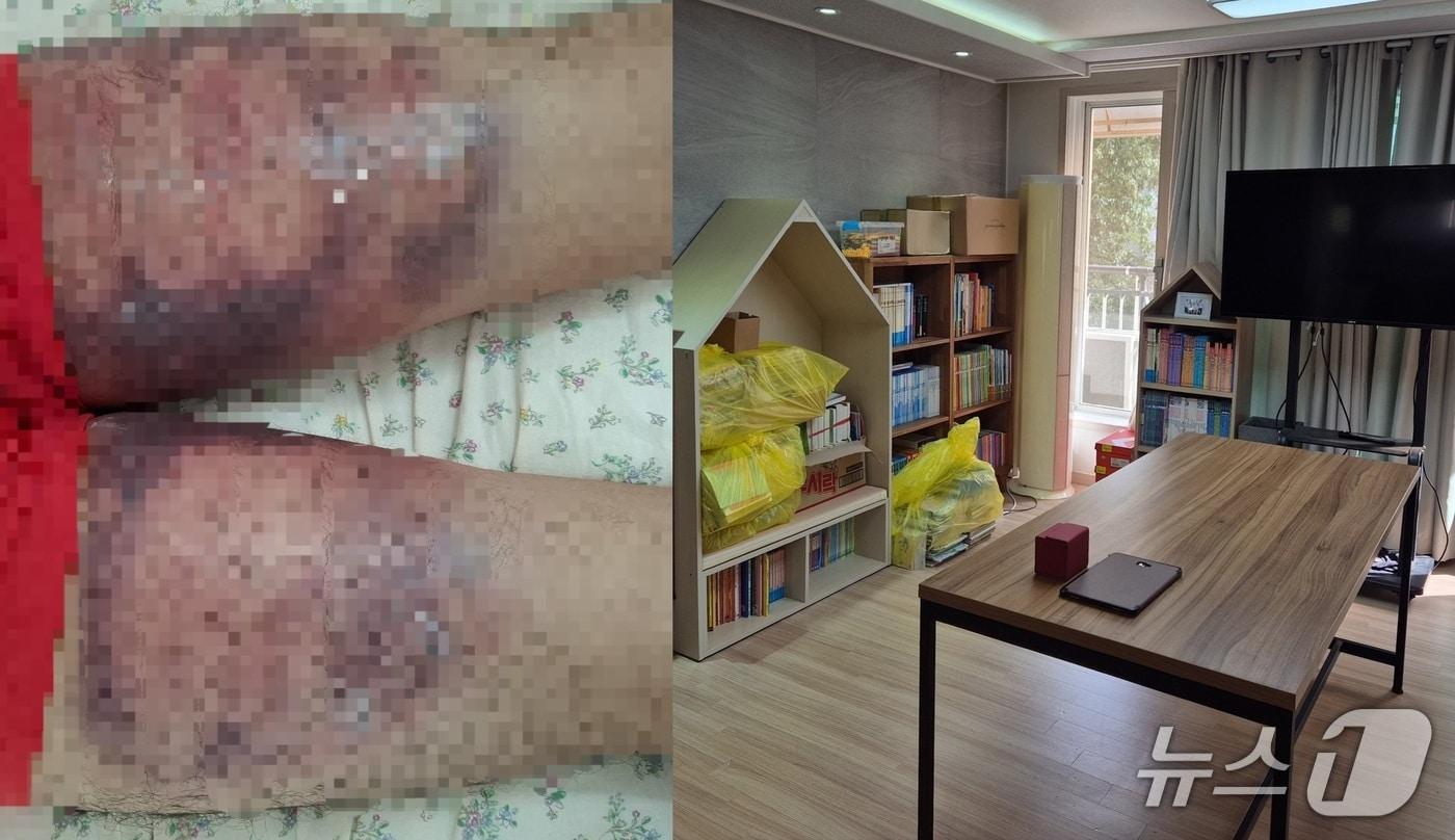 9월 29일 경기 광주시에 위치한 대안가정의 모습. 경계선지능인 지원단체가 운영하던 해당 대안가정에서 전 대표가 성폭력·폭행·노동 착취를 했단 의혹이 불거졌다. 2025.9.29/뉴스1 ⓒ News1