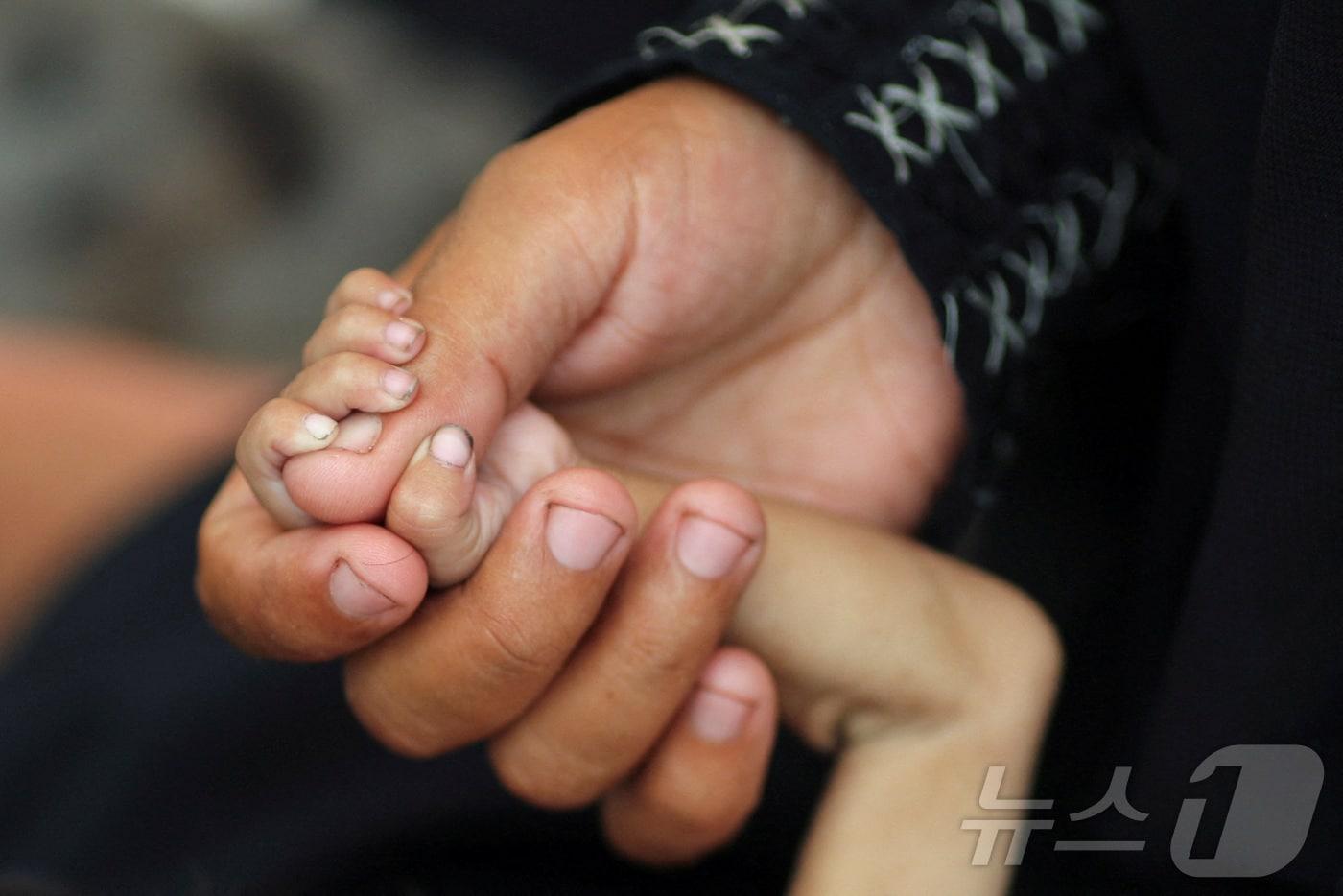 8월 5일&#40;현지시간&#41; 팔레스타인 가자지구 가자시티에서 한 어머니가 영양실조로 쇠약해진 생후 5개월 자녀의 손을 잡고 있다. 2025.08.05. ⓒ 로이터=뉴스1 ⓒ News1 윤다정 기자