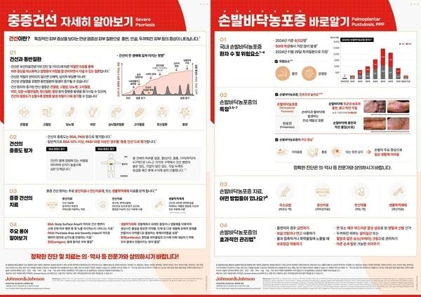 본문 이미지 - 중증 건선·손발바닥 농포증 인포그래픽 / 이미지=㈜한국얀센 제공