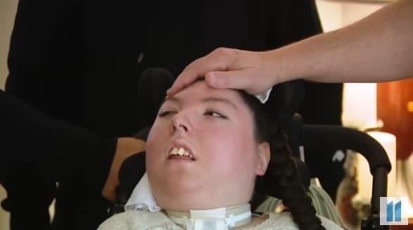 희귀 질환인 &#39;수뇌증&#39;을 앓고 있는 미국의 20세 여성의 사연이 화제가 되고 있다. 출처=피플