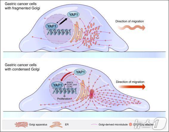 본문 이미지 - 위암 세포 내 골지체의 응축된 구조 변형이 암 촉진 인자인 YAP1을 활성화시켜 암의 악성화를 유도하는 과정을 설명하는 모식도&#40;가톨릭대학교 가톨릭중앙의료원 제공&#41;