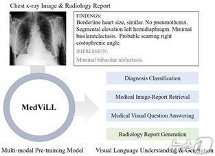 본문 이미지 - 엑스레이 이미지와 의사 판동문&#40;텍스트&#41;을 함께보며 AI훈련시키는 과정&#40;KAIST 제공&#41; /뉴스1