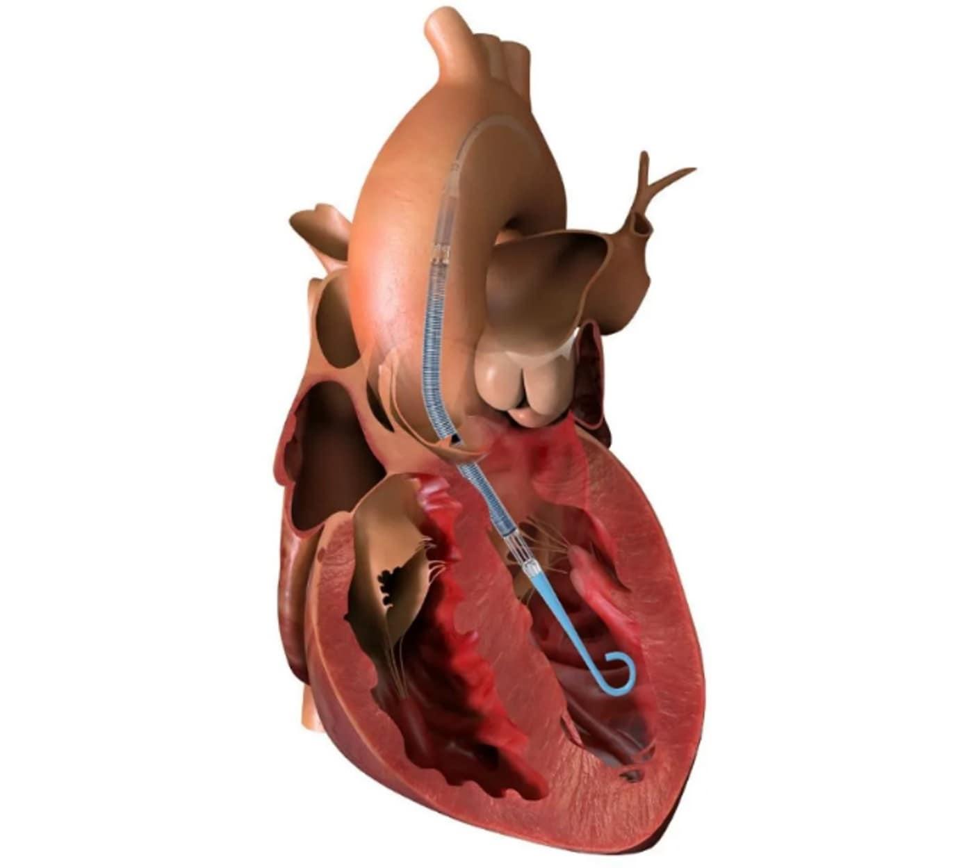 본문 이미지 - &#40;존슨앤드존슨 메드테크 제공&#41;