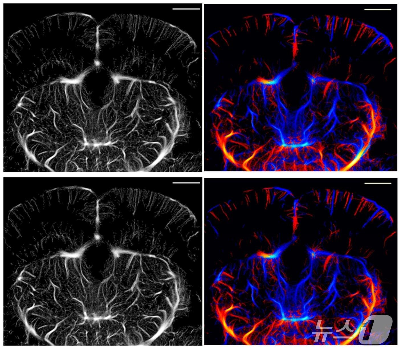 본문 이미지 - ULM으로 획득한 쥐 뇌 모세혈관 영상&#40;위&#41;과 ULM-Lite 기법으로 획득한 모세혈관 영상.&#40;DGIST 제공, 재판매 및 DB 금지&#41;