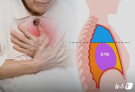 본문 이미지 - 기관지, 식도, 대동맥, 심장 등 생명 유지에 필요한 주요 장기가 모두 '종격동' 안에 있다. 다소 생소하지만 '종격동'은 가슴뼈와 척추 사이 빈 공간을 지칭한다. 이런 데 물혹이나 양성 종양 또는 악성 종양(암)을 '종격동 종양'이라고 한다. ⓒ News1 양혜림 디자이너