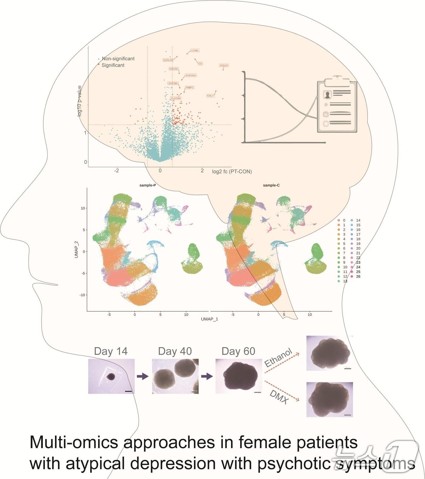 본문 이미지 - 주요우울장애 여성에서 임상증상, 혈액 분석 및 환자 유래 뇌오가노이드 분석 통합&#40;KAIST 제공&#41; /뉴스1