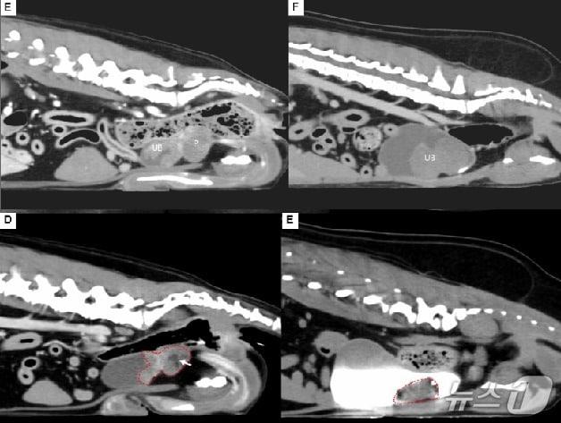 본문 이미지 - 색전술로 종양 치료 전(상단)과 후(하단) CT 촬영 모습(해마루 제공) ⓒ 뉴스1