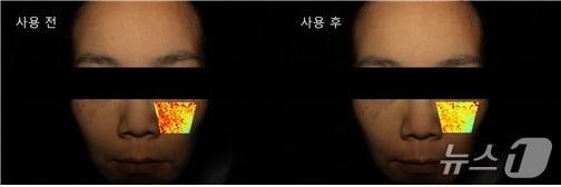 본문 이미지 - 모아라이프플러스는 &#39;닥터스피지에이 로즈엑소부스터&#39; 인체적용시험 결과 4주 사용 후 피부 멜라닌 색소 침착&#40;붉은색&#41;이 유의미하게 감소했다고 밝혔다.&#40;모아라이프플러스 제공&#41;