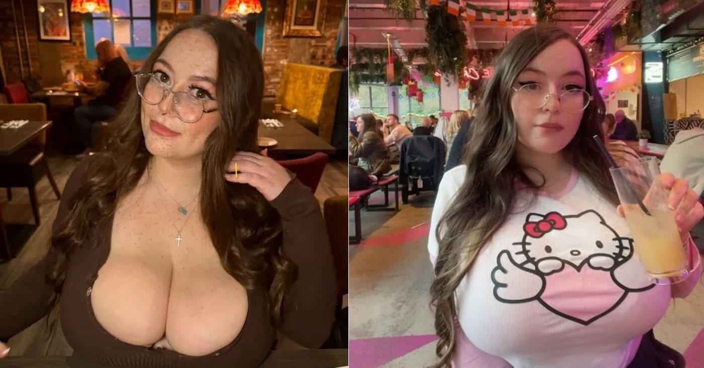 25세 스코틀랜드 출신 여성 서머 로버트는 어린 시절부터 가슴이 멈추지 않고 커지는 '거대유방증'을 앓고 있다. 출처=더선