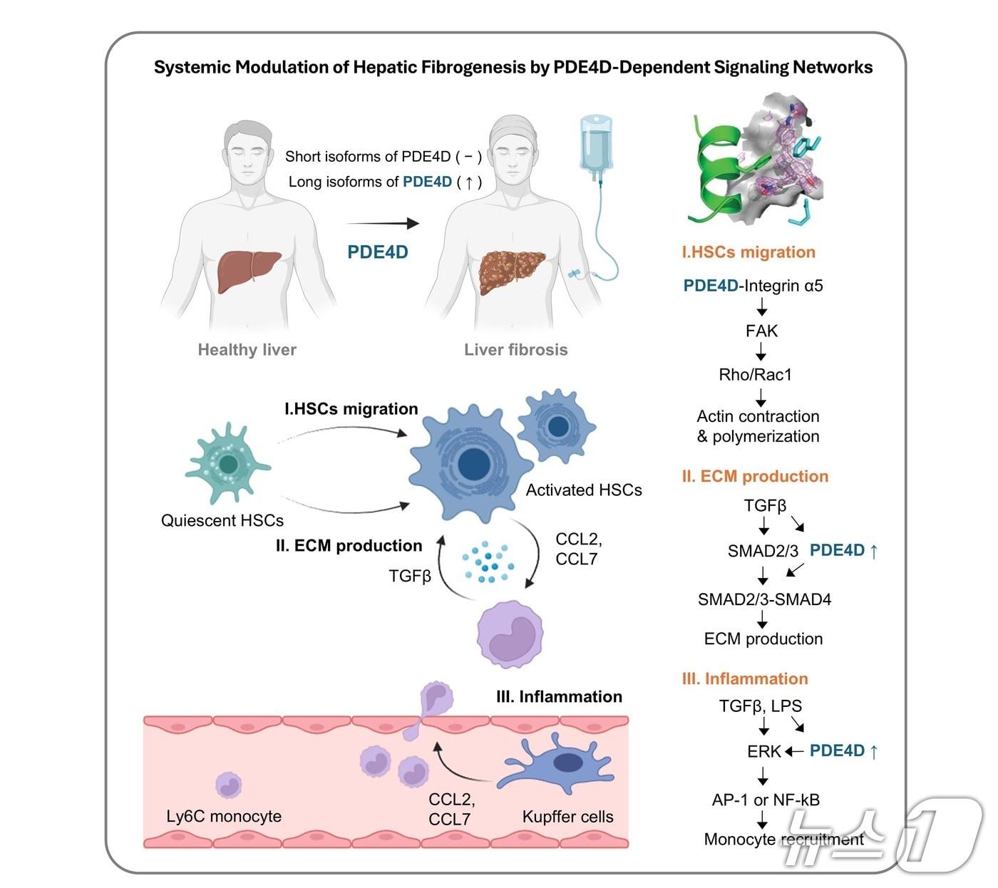본문 이미지 - 간 섬유화 단계의 특이적 치료 표적인 PDE4D의 역할과 알로스테릭 저해제의 섬유화 조절 기전을 설명하는 모식도&#40;가톨릭중앙의료원 제공&#41; 2025.11.26/뉴스1