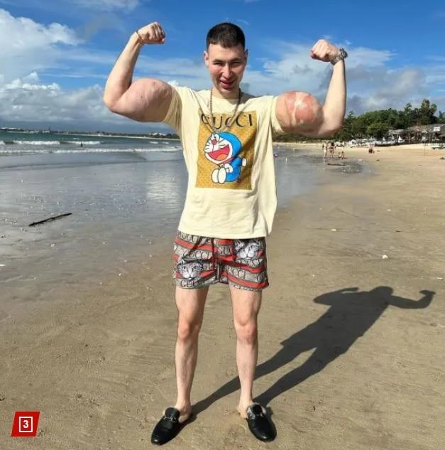 본문 이미지 - 러시아 보디빌더 키릴 테레신&#40;29&#41;. 출처=뉴욕포스트