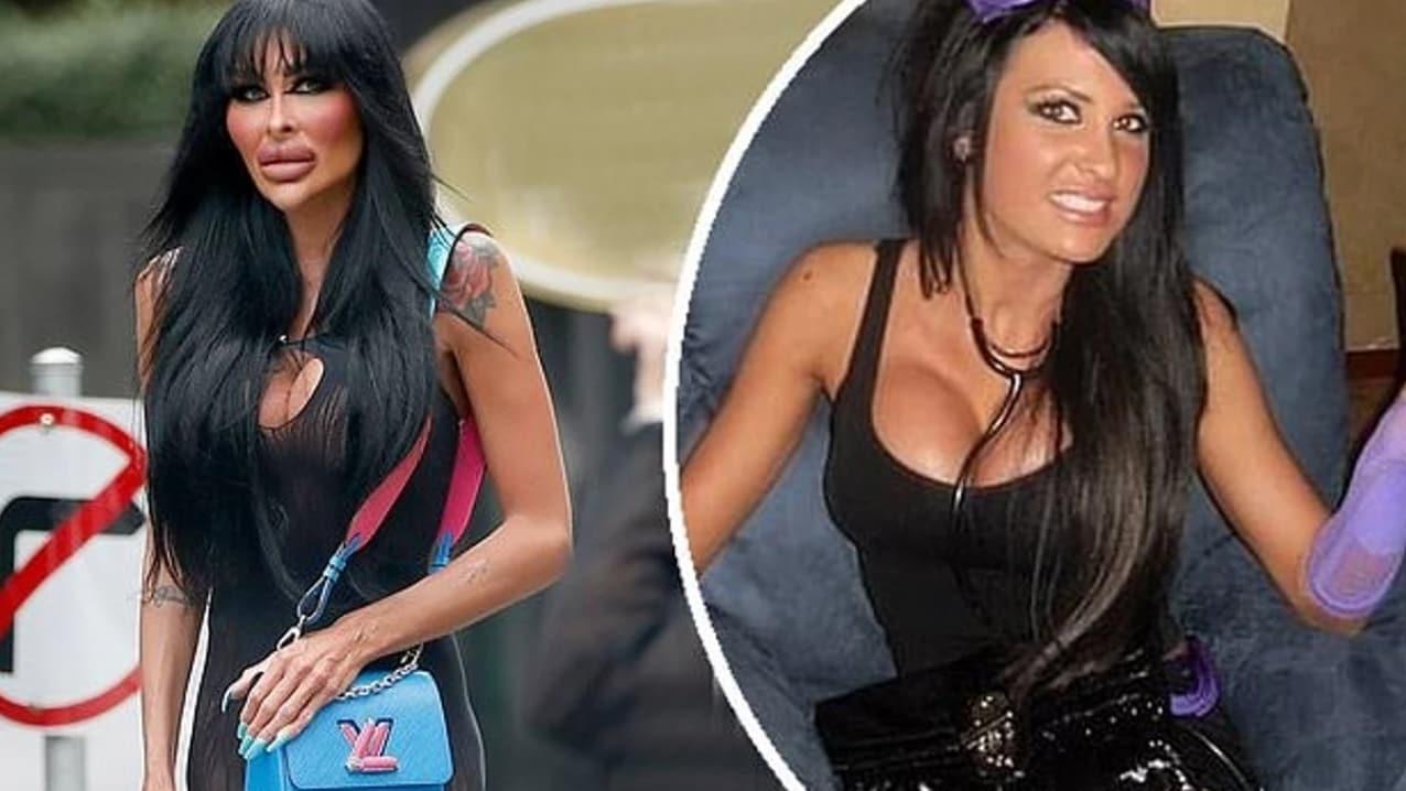 호주 출신 여성 타라 제인 맥코나키 수술 전과 후 사진. 출처=더선