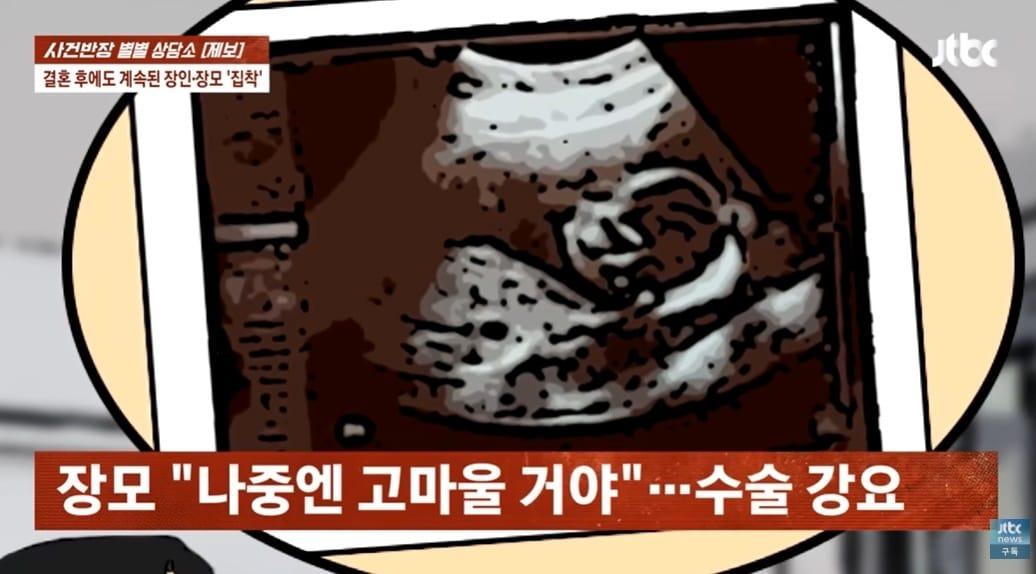 본문 이미지 - (JTBC '사건반장' 갈무리)