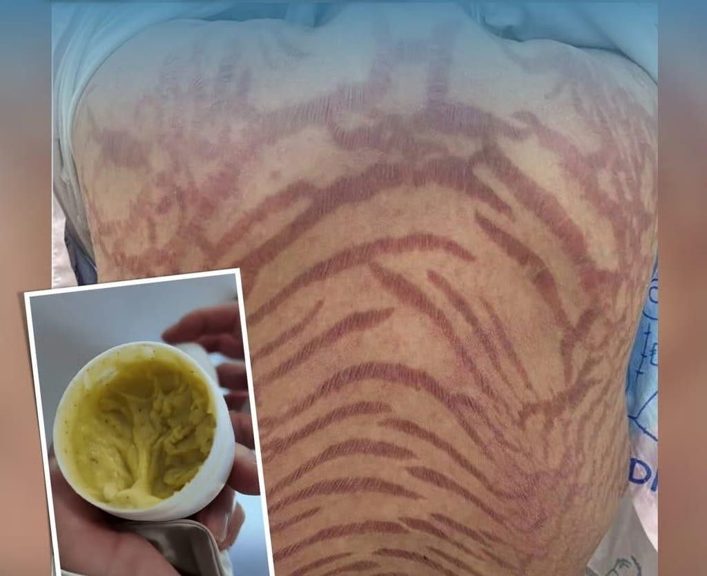 본문 이미지 - (SCMP 갈무리)