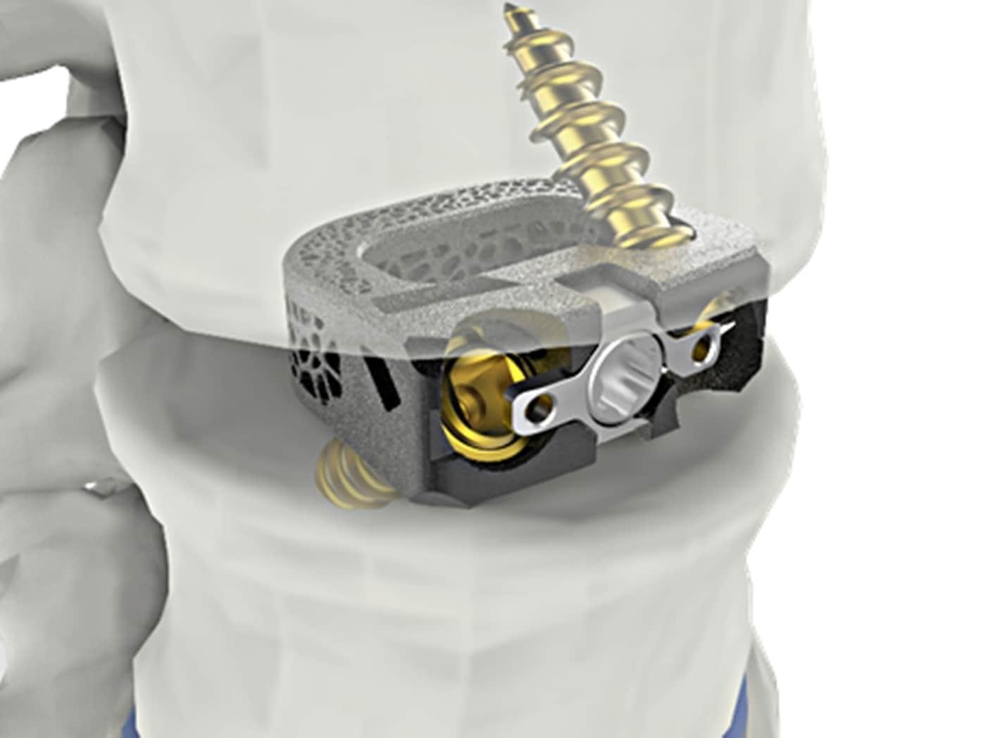 본문 이미지 - 시지메드텍 제공