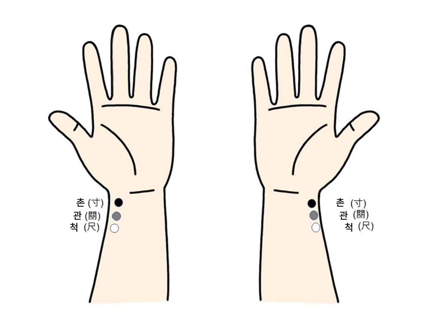 본문 이미지 - 좌우 맥 강도 차이 측정 위치.&#40;강동경희대병원 제공&#41;