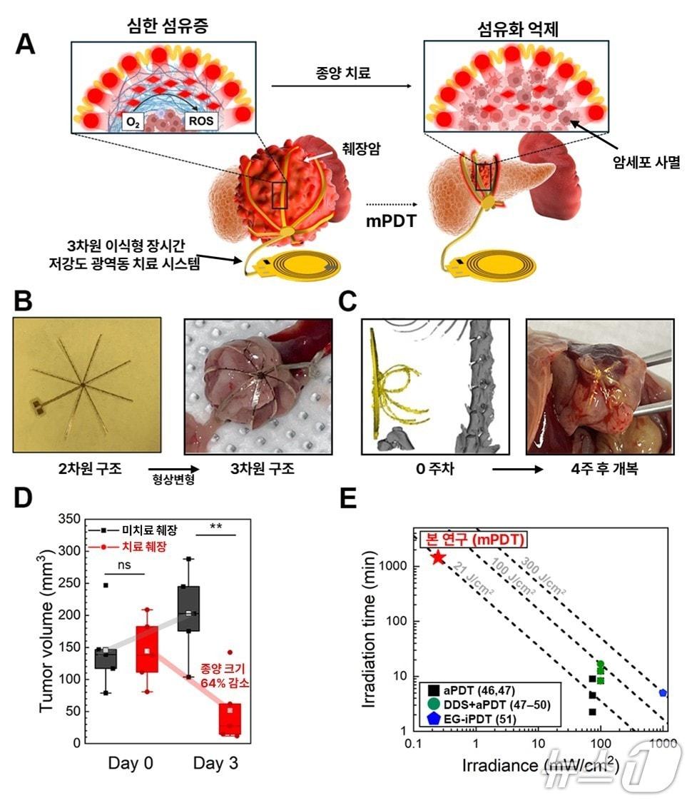 본문 이미지 - 3차원 장시간 저강도 광역동치료 시스템 개요(KAIST 제공) /뉴스1