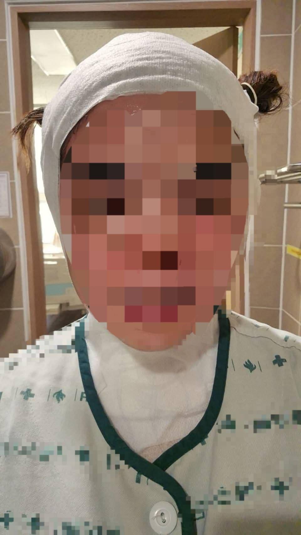 본문 이미지 - 화상 입은 30대 태국인 여성&#40;페이스북 갈무리. 재판매 및 DB 금지&#41;/뉴스1