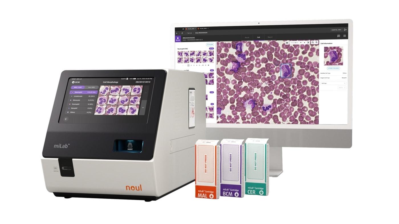  노을 AI 기반 혈액 및 암 진단 플랫폼 마이랩(miLab) 디바이스와 카트리지. (노을 제공)