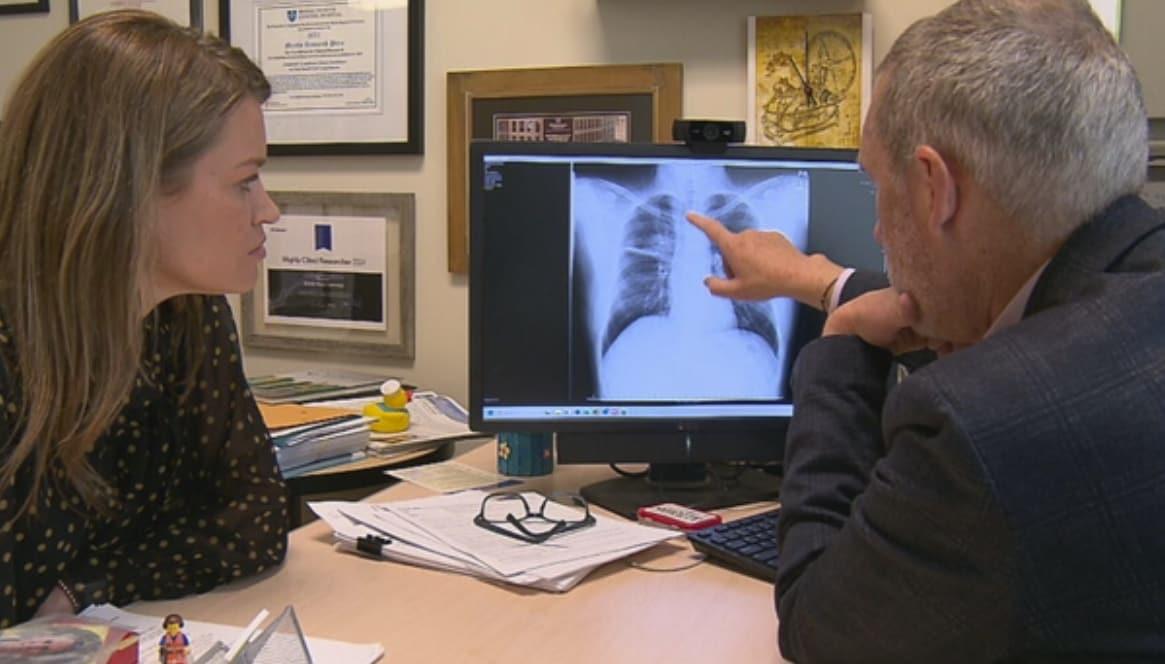 자신의 폐암 진행도를 확인하고 있는 '폐암 권위자' 로스 카미지(58) 박사. 출처=CBS