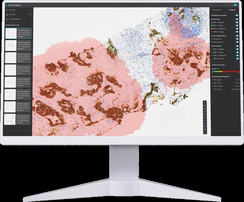 본문 이미지 -  Lunit SCOPE HER2. (루닛 제공)