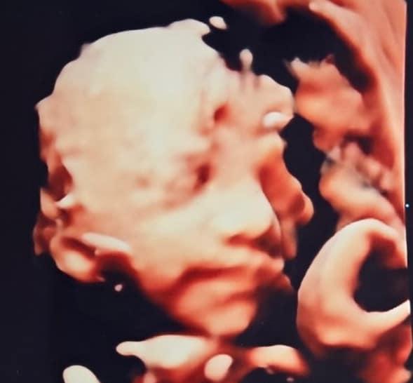 본문 이미지 - 손담비 태아 사진