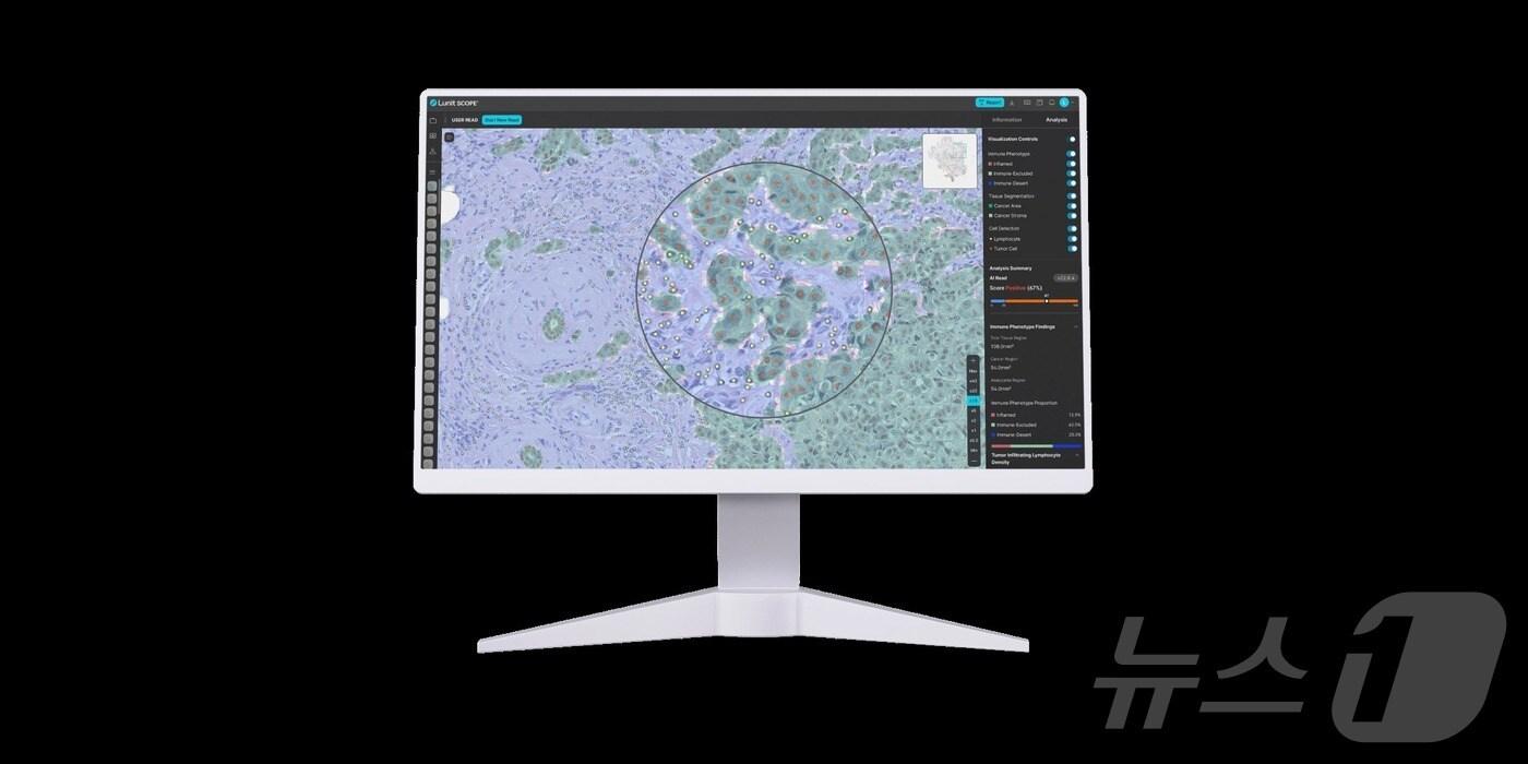 루닛 스코프 IO 활용 모습.(루닛 제공)/뉴스1