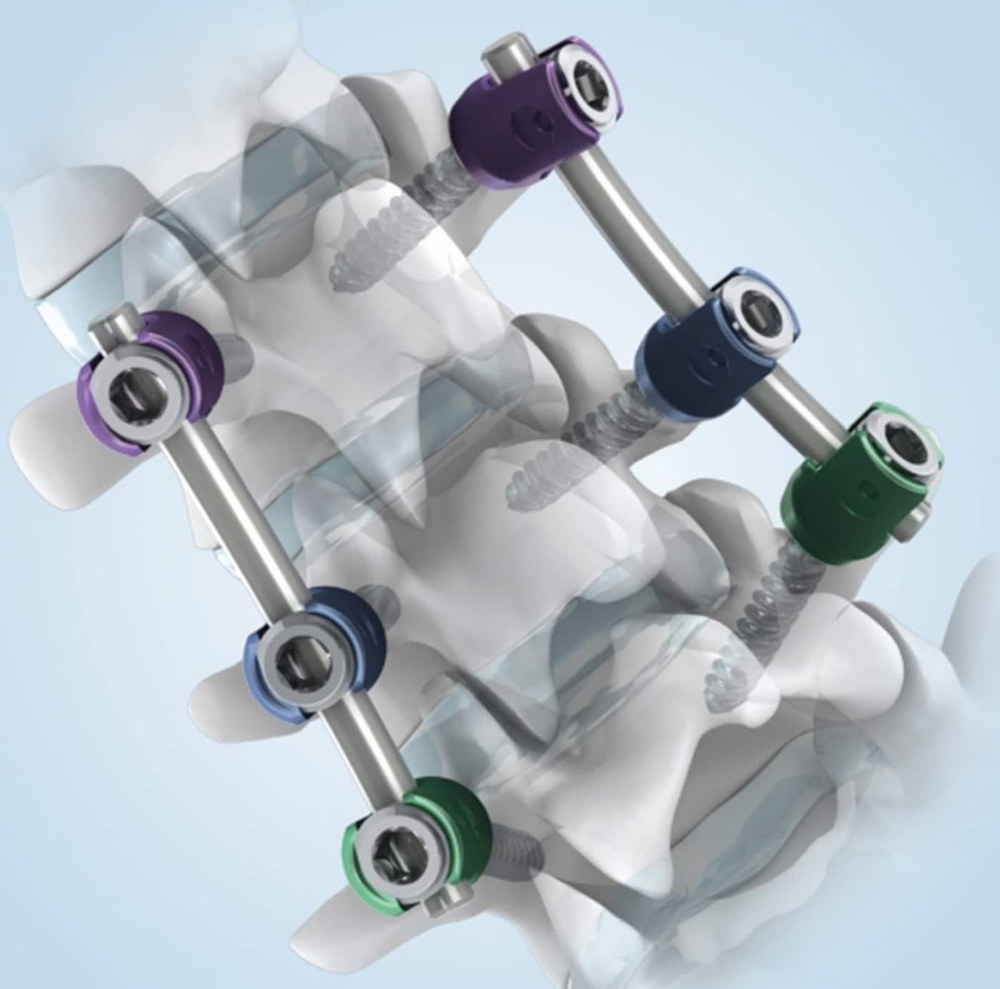 본문 이미지 - 시지메드텍 제공