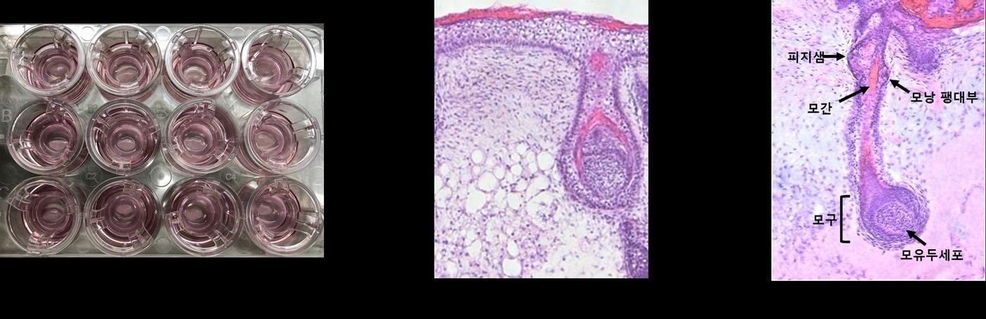 강스템바이오텍의 피부 오가노이드는 실제 피부와 동일한 형태의 3차원 구조로써 표피층, 진피층, 피하지방 및 모낭조직까지 완벽히 구현됐다.&#40;강스템바이오텍 제공&#41;