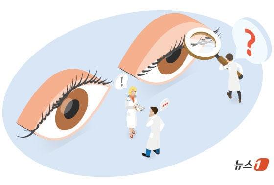 본문 이미지 -  일반적으로 눈 성형이라 하면 쌍꺼풀 수술과 같은 미용성형을 떠올리는데 최근 치료를 동반하는 눈꺼풀 성형수술을 받는 중·장년이 늘고 있다. / 뉴스1 ⓒ News1