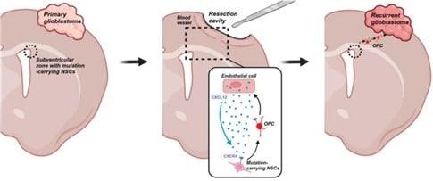 본문 이미지 - 교모세포종 재발 매커니즘 모식도. 초발 교모세포종&#40;왼쪽&#41;에서는 암 유발 원인인 돌연변이 유전자를 가진 신경줄기세포가 뇌 깊은 곳에서 위치한다. 초발 종양을 수술로 제거해도&#40;중앙&#41; 혈관내피세포가 분비하는 신호가 신경줄기세포를 자극하여 재발 부위로 이동을 촉진한다. 재발 교모세포종&#40;오른쪽&#41;에서는 이동한 신경줄기세포가 재발암을 형성한다.&#40;서울대병원 제공&#41;