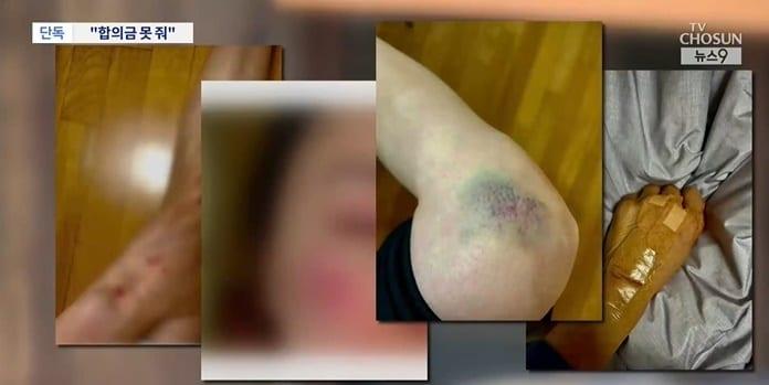 본문 이미지 - (TV조선 갈무리)