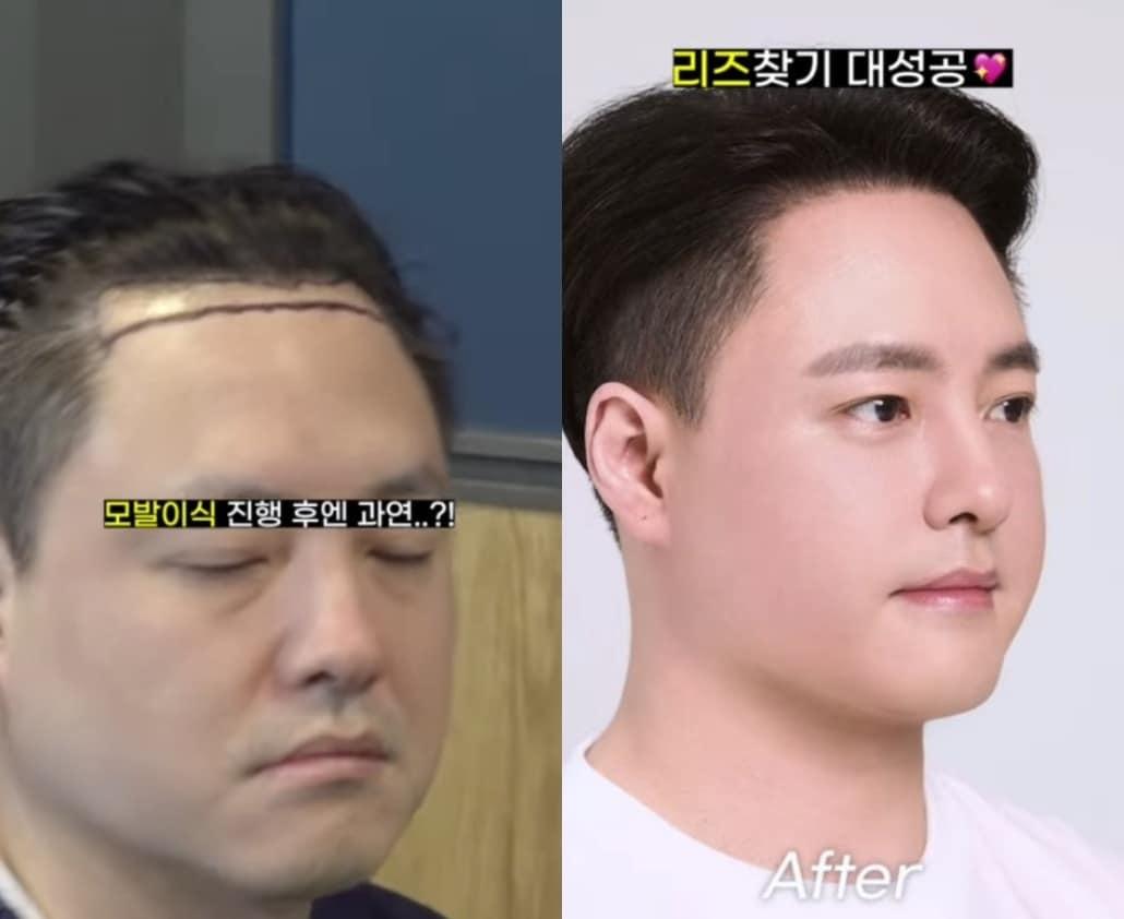 본문 이미지 - 사진=노유민 인스타그램 갈무리