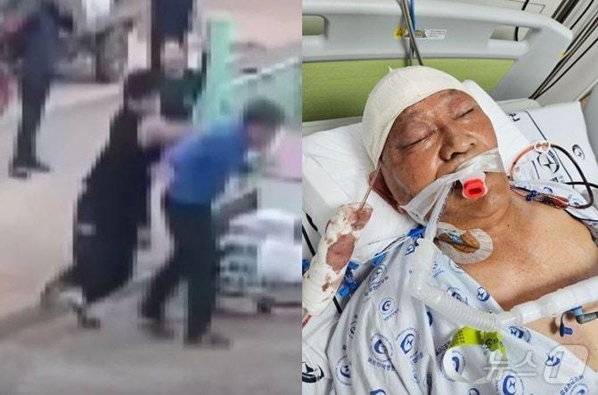 본문 이미지 - (온라인 커뮤니티 '보배드림' 갈무리) /뉴스1