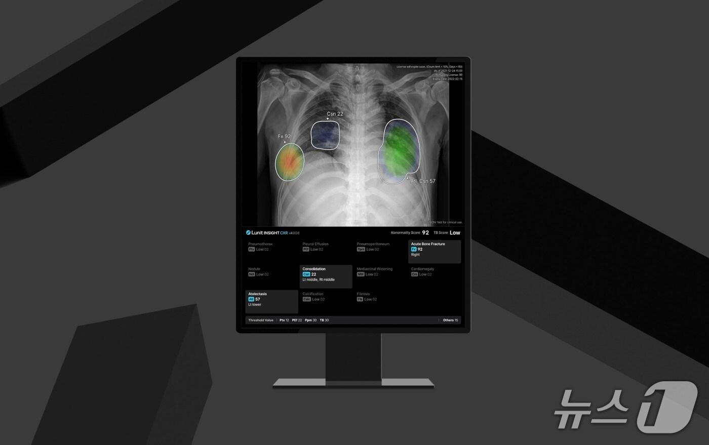루닛 인사이트 CXR4.(루닛 제공)/뉴스1