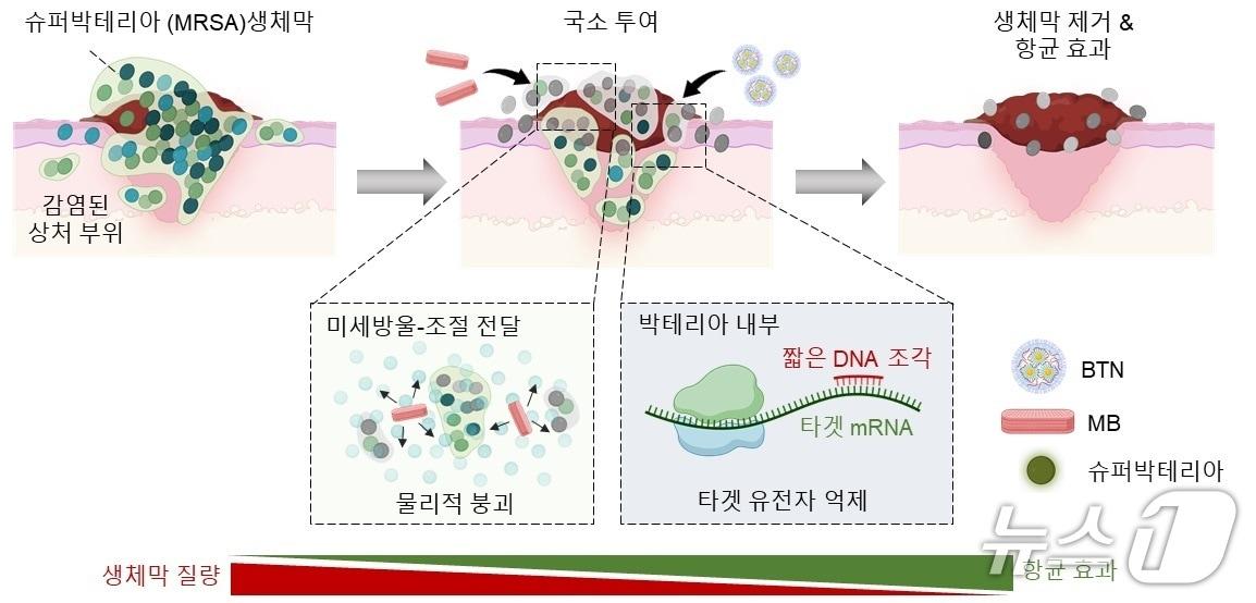 본문 이미지 -  슈퍼박테리아를 표적하는 유전자 치료제의 작동 원리 모식도(KAIST 제공) /뉴스1