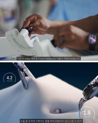 본문 이미지 - (인튜이티브서지컬코리아 제공)