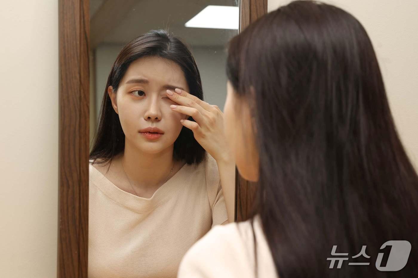 헤르페스 바이러스가 영향을 주는 눈 부위에 따라 눈꺼풀염, 각막염, 결막염 등으로 나타날 수 있다.(김안과병원 제공)