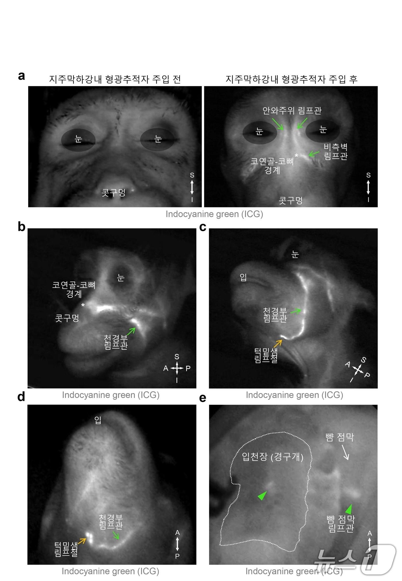 본문 이미지 - 영장류에서 확인된 뇌 척수액 배출 림프관 분포.&#40;IBS 제공&#41;/뉴스1