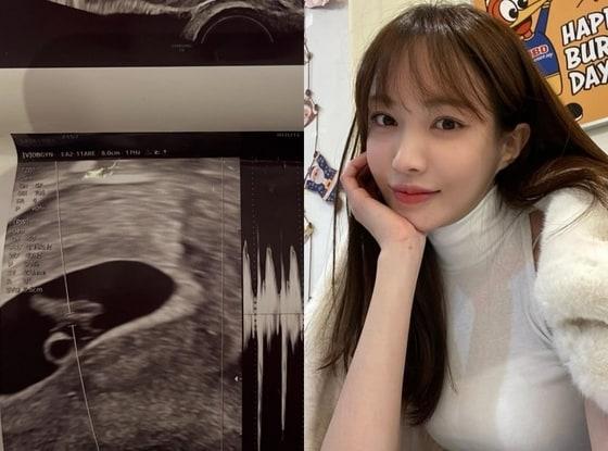 본문 이미지 - 서민재 인스타그램