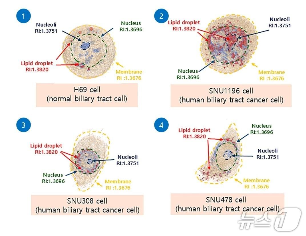 본문 이미지 - 담관암 세포와 정상세포 3D 광회절단층촬영 영상이미지 차이(한림대학교동탄성심병원 제공)