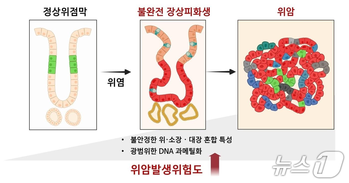제주대 의과대는 불완전 장상피화생이 위암 전단계임을 과학적으로 최초 입증했다고 밝혔다.(제주대학교 제공. 재판매 및 DB 금지)