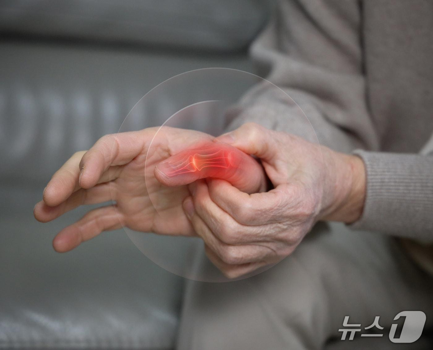 본문 이미지 - 일상생활이나 작업장 등에서 불의의 사고로 손가락이 절단된다면 어떻게 대처해야 할까.(이대서울병원 제공)